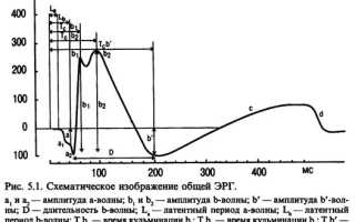 Электроретинография
