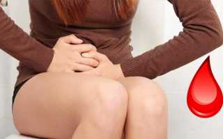 Причины поноса с кровью у взрослого и методы лечения