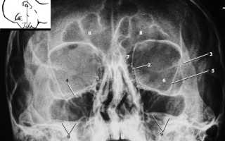 Методика рентгенлокализации по Комбергу-Балтину