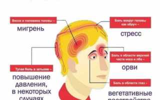 Головная боль в височной области