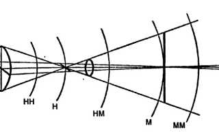 Астигматизм
