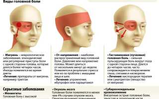 Головная боль в затылочной части
