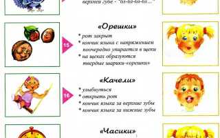 Как восстановить речь после инсульта?