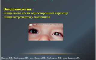 Аномалии развития глазницы