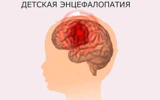 Ишемическая болезнь мозга у новорожденных