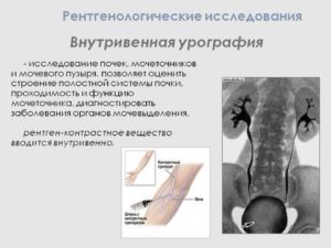 Как называется контрастное вещество для почек