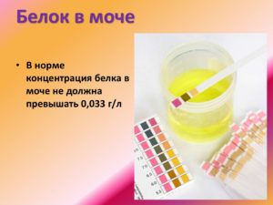 Как повысить белок в моче