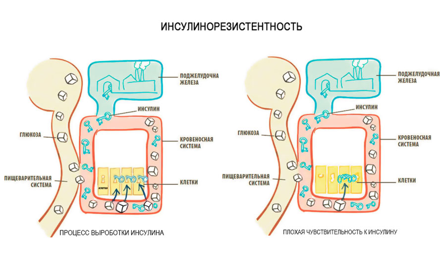 ИНСУЛИНОРЕЗИСТЕНТНОСТЬ