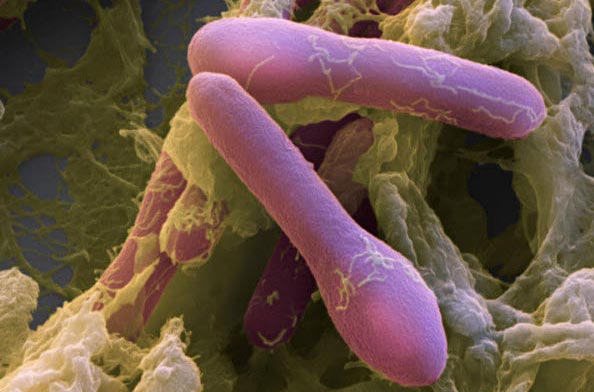 Палочки ботулизма Палочки ботулизма