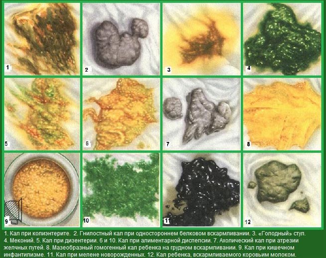 Цвет поноса цвет поноса