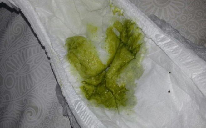 Понос зеленого цвета понос зеленого цвета