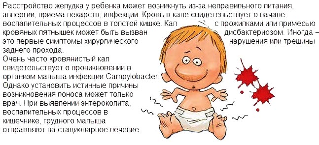 Жидкий стул с примесью крови